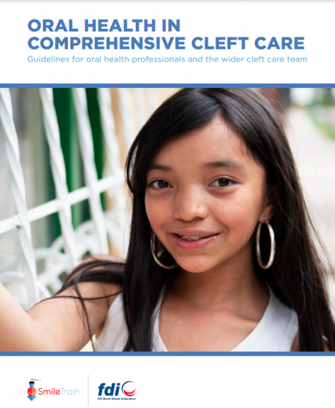 Oral health in comprehensive cleft care_chairside guide